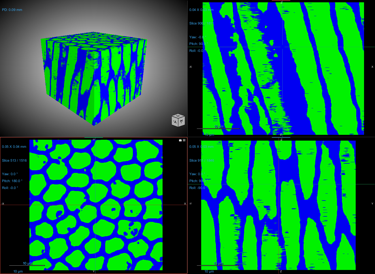 Noise2Inverse denoising — before / after